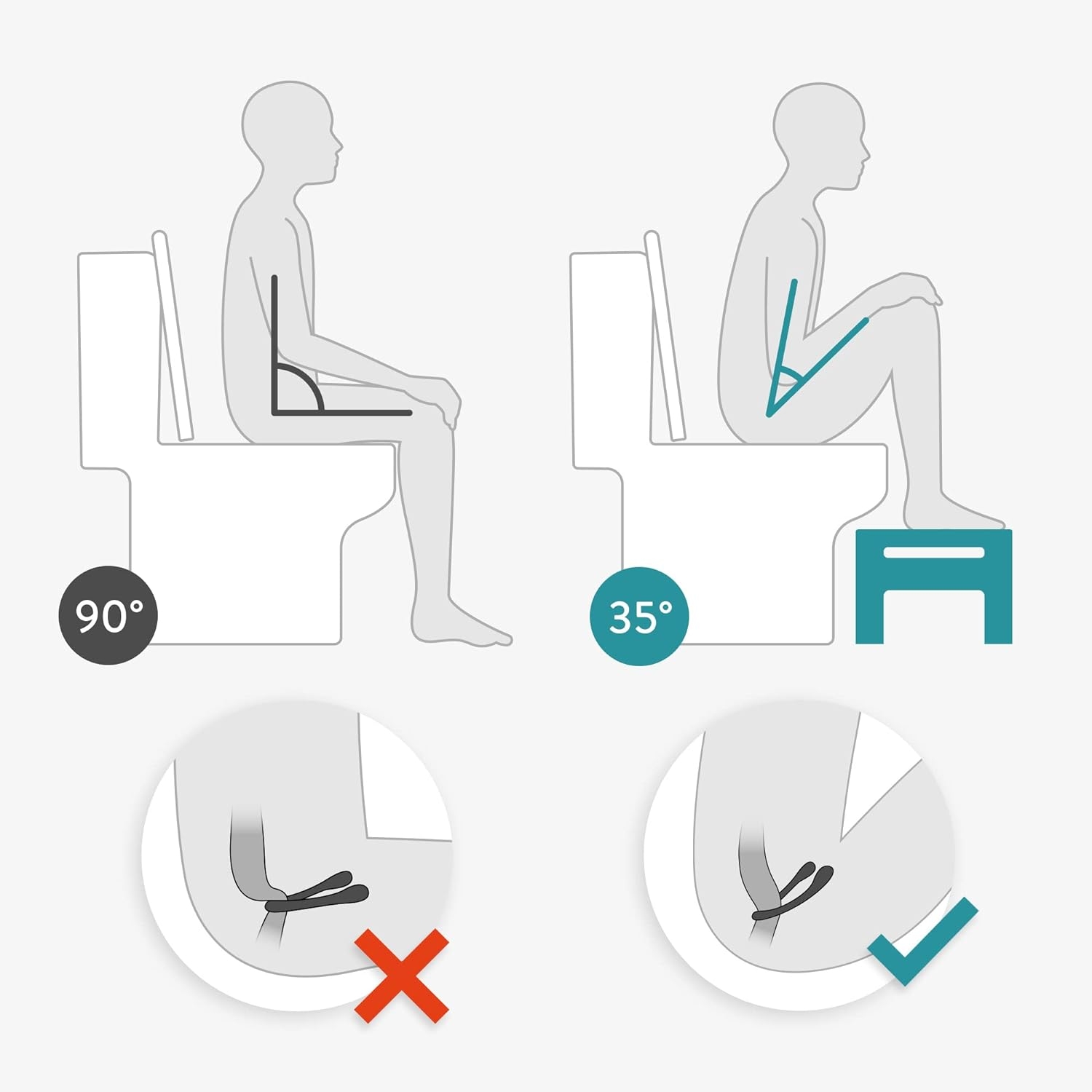 navaris-toilet-stool-voithitiko-ergonomiko-antiolisthitiko-skampo-toualetas-mpaniou-apo-mpampou-white-5.jpg